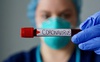 В Україні за добу зафіксували 24 518 випадків коронавірусу, на Волині – 515