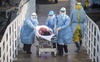 Четверо волинян померли від ускладнень коронавірусу