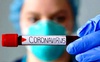 Де на Волині зафіксували 254 нових випадки коронавірусу