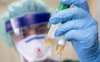 На Волині за добу 420 нових хворих і 2 смерті від коронавірусу: ситуація по області