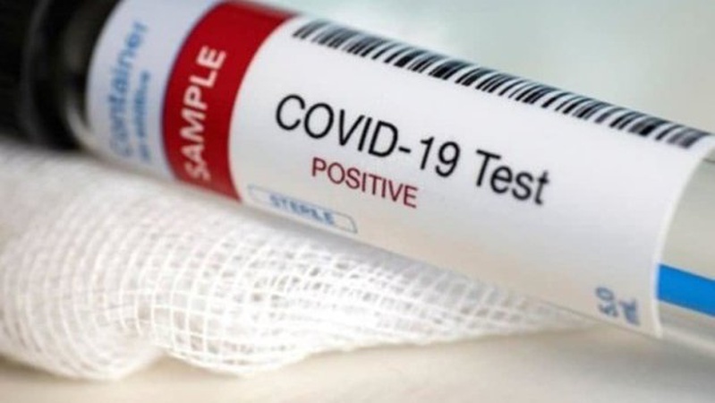 В Україні за добу виявили 20 156 нових випадків COVID-19, на Волині – 400