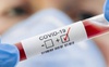 В Україні за добу підтвердили 23 378 інфікувань коронавірусом, на Волині – 586