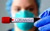 На Волині 571 інфікування і 25 смертей від коронавірусу за добу