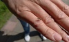 Засилля комарів у Луцьку: що кажуть екологи і лікарі.ВІДЕО