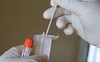 Що відомо про новий штам коронавірусу та чи зафіксували його в Україні