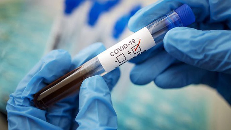 В Україні за добу – 619 нових хворих на коронавірус, на Волині – 8