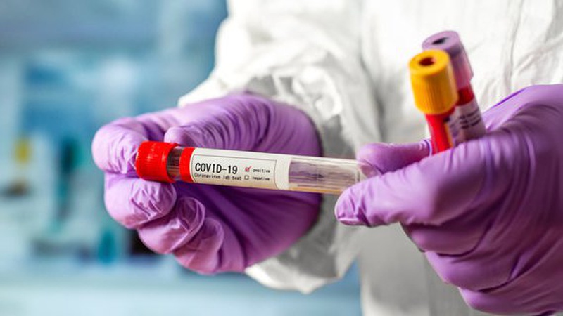 В Україні за добу підтвердили  31 125 заражень коронавірусом, на Волині – 949