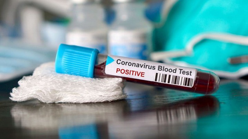 На Волині виявлено коронавірус у 74 осіб, летальних випадків не зареєстровано
