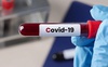 На Волині зросла захворюваність на COVID-19, є летальний випадок
