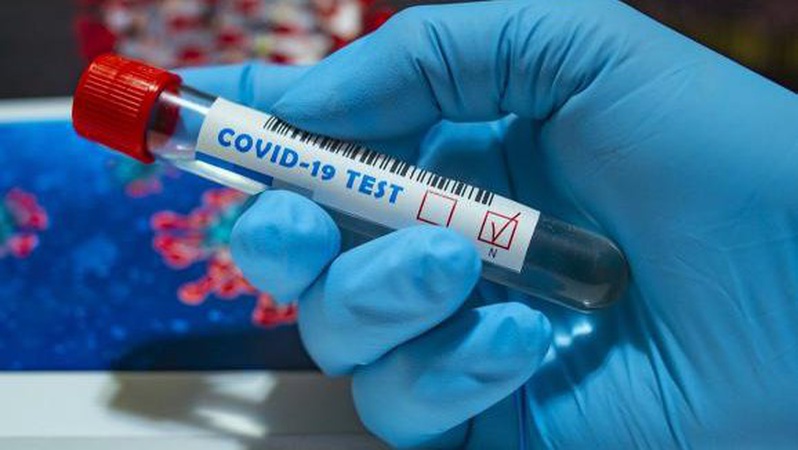 На Волині 426 нових випадків коронавірусу, в Україні – 17 479