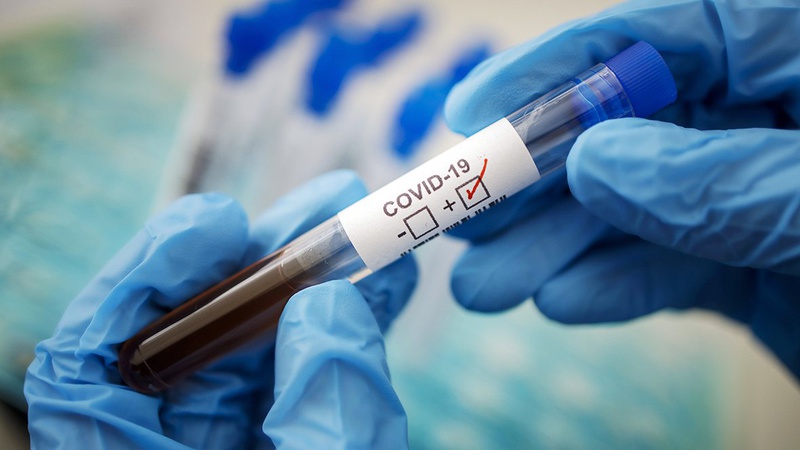 В Україні за добу зафіксували 27 851 випадок коронавірусу, на Волині – 462
