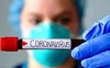 За тиждень на Волині від коронавірусу померло 5 людей