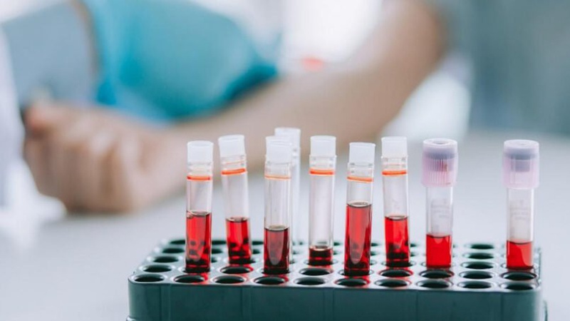 Аналіз крові на антитіла до герпесу типу 2 (HSV-2)*