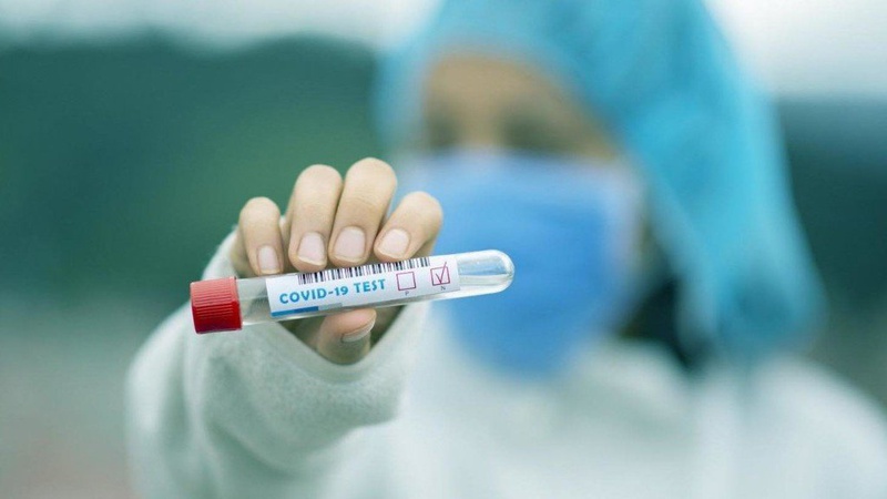 В Україні 1054 новий випадок коронавірусу, на Волині – 3