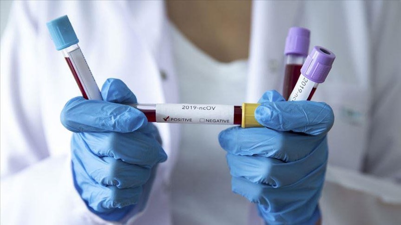 В Україні 890 нових випадків коронавірусу, на Волині – 6