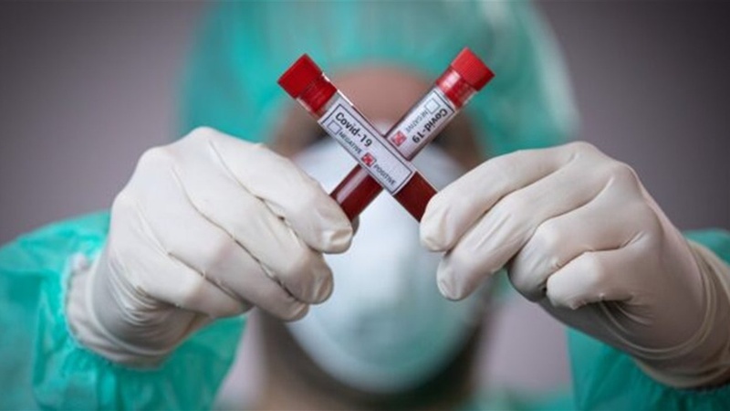 В Україні 1188 нових інфікувань коронавірусом, на Волині – 36