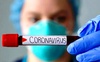«Ріст відбувається у всіх вікових групах населення», – головний лікар Волині про коронавірус