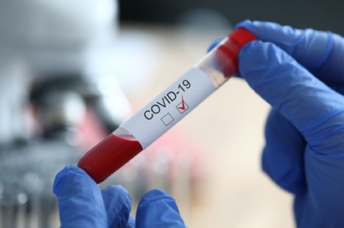 Де на Волині виявили 240 нових хворих на коронавірус