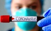 На Волині 254 нові випадки коронавірусу, в Україні – 11 226