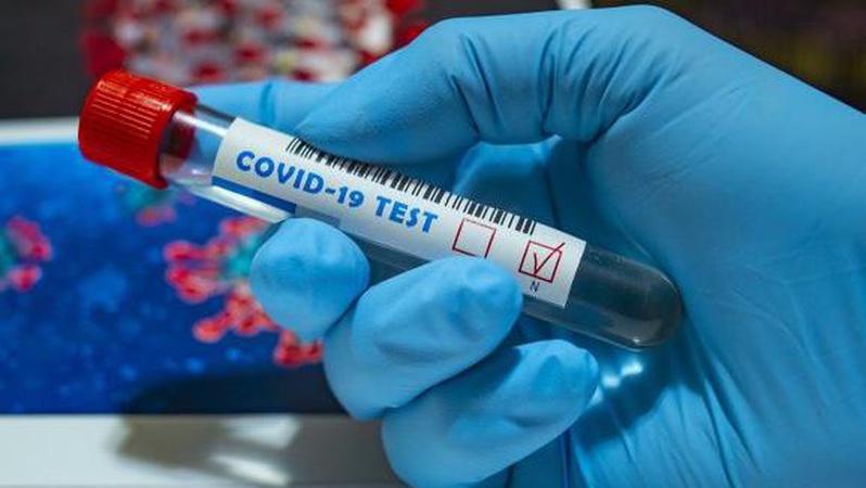 В Україні за добу 19 118 інфікувань коронавірусом, на Волині – 492