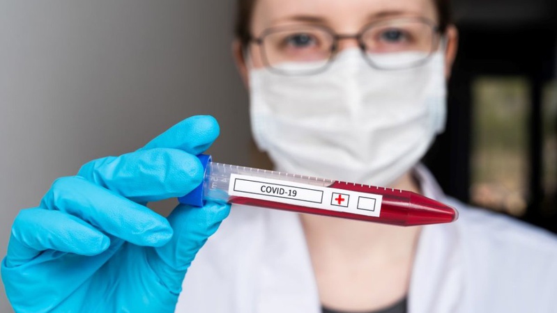 В Україні за добу – 633 випадків коронавірусу