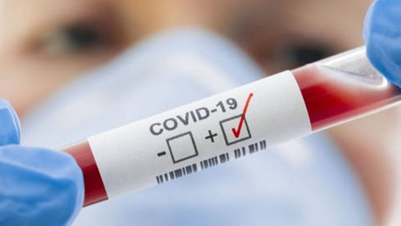В Україні за добу – найбільша кількість виявлених заражень COVID-19 з початку пандемії