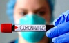 В Україні в неділю виявили 1 969 інфікувань коронавірусом, на Волині – 48
