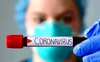 Яка ситуація із хворими на коронавірус у Нововолинську