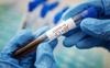 В Україні за добу виявили 4821 новий випадок коронавірусу, на Волині – 203