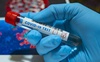 На Волині за добу виявили 601 інфікованого коронавірусом, померло від ускладнень 10 чоловік