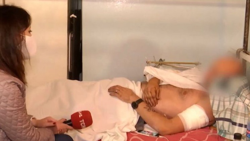 Хореографу з Волині рятують кінцівки після поранень на Донеччині