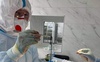 Волинські хірурги видалили з руки ковідного хворого 15-сантиметровий тромб. ФОТО 18+