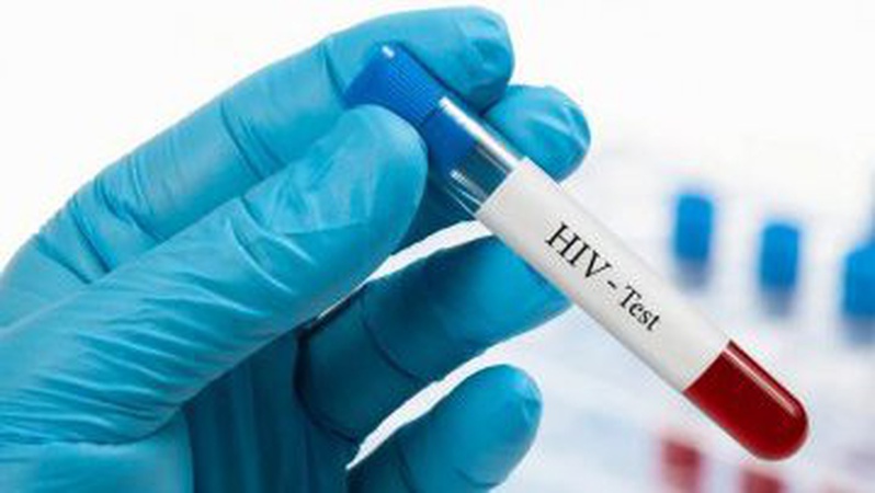 У Луцьку 1 грудня безкоштовно робитимуть тестування на ВІЛ/СНІД та гепатит С