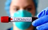 Коронавірус: в Україні за добу – 1603 інфікування, на Волині – 52