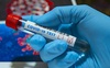 455 нових хворих, 10 померлих від коронавірусу: статистика на Волині за добу